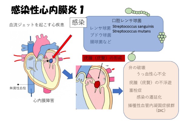 心臓病との関連